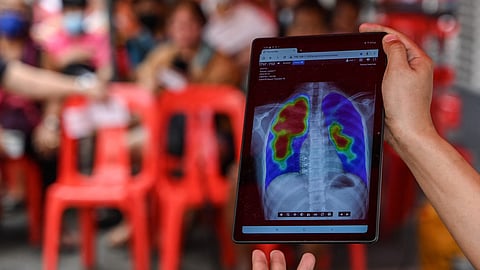 A medical worker shows an x-ray result during a tuberculosis screening.