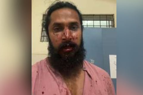 Actor Chethan Chandra assaulted by miscreants