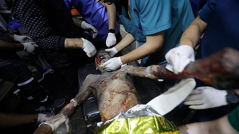 Palestinian medics treat a boy seriously wounded in the Israeli bombardment of the Gaza Strip at the Kuwaiti Hospital in Rafah refugee camp, southern Gaza Strip