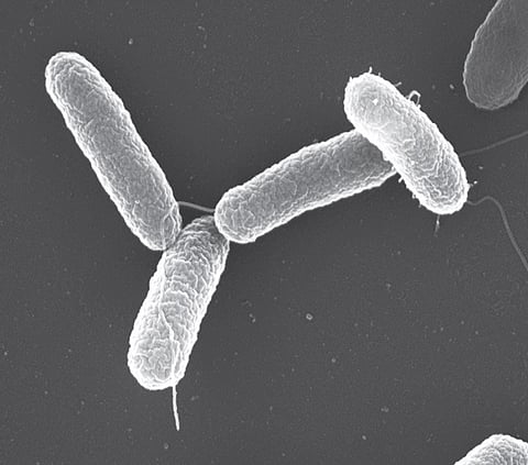 Salmonella typhimurium