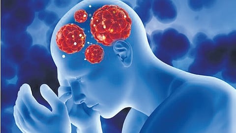 Image used for representation