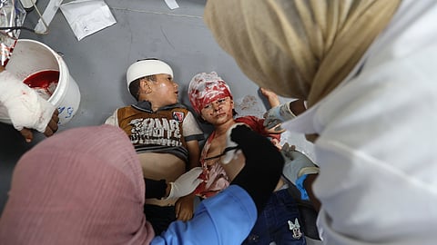 Palestinian children wounded in the Israeli bombardment of the Gaza Strip are treated in al-Aqsa Hospital in Deir al Balah.
