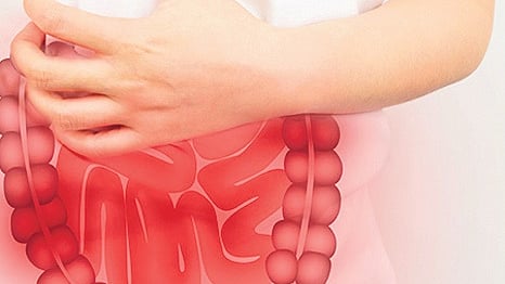 Coping with IBS: Understanding the invisible condition, finding relief