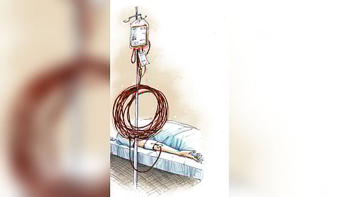 Representative image