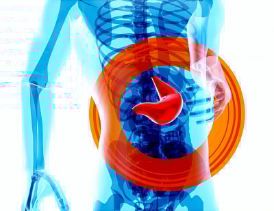 Representative image.