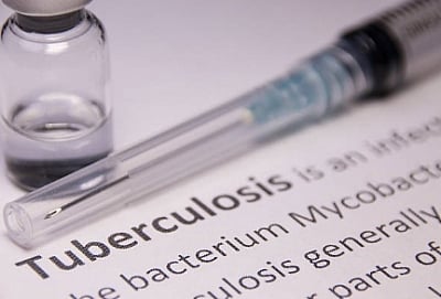 Sorbequiline, a new antibiotic, likely to serve as a breakthrough in tuberculosis treatment
