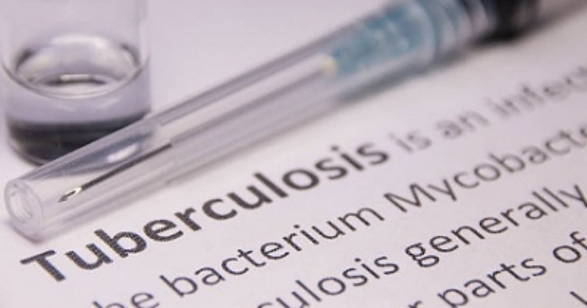 Sorbequiline, a new antibiotic, likely to serve as a breakthrough in tuberculosis treatment Sorbequiline, a new antibiotic, likely to serve as a breakthrough in tuberculosis treatment