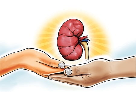 Kidney Transplantation
