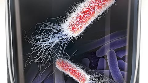 Representative image