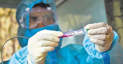 Image used for representational purposes only