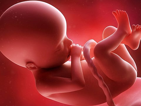 Representative Image