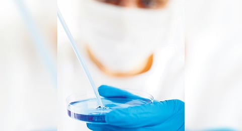 Representative image