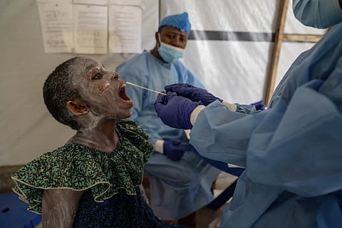 A health worker takes a saliva sample from Lucie Habimana, 13, an Mpox patient, at a treatment centre in Munigi, eastern Congo.