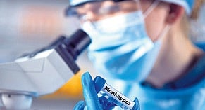 This virus came into the limelight once again in 2022 as there were new cases reported in the areas that were non-endemic and were not associated with travel-related spread.