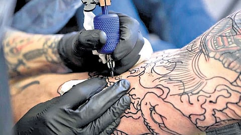 Representative image