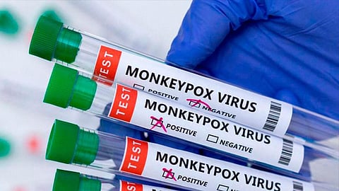 'Is Mpox deadly?': Know more about its outbreak and causes