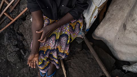 Representative Image