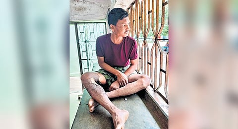 Injured assistant Havildar Dehury