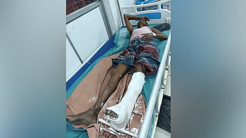 Sekar suffered hip injuries apart from the fracture in his left leg.