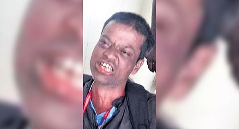 Doctor Arrives Drunk at Vijayapura Hospital, Karnataka