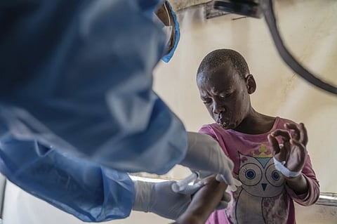 A health worker attends to an mpox patient, at a treatment center in Munigi, eastern Congo, Aug. 19, 2024. 