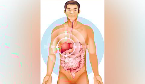 Representational image