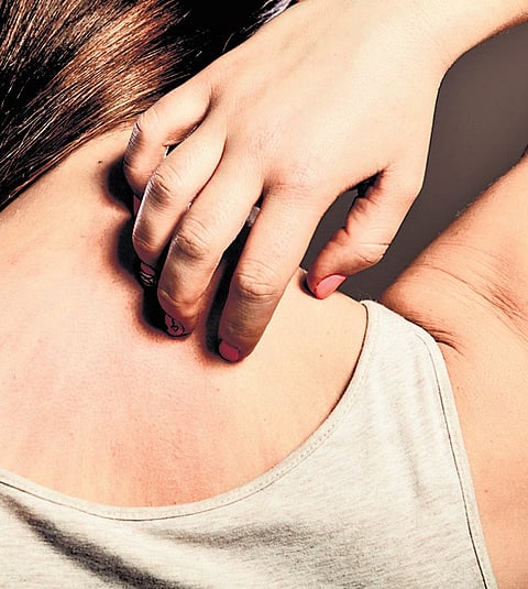 Representational image