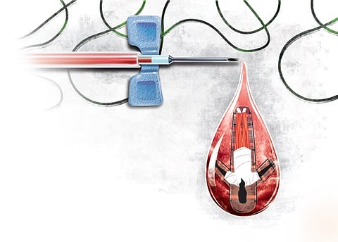 Under the Clinical Establishment Act, only registered practitioners should be employed in hospitals. If the doctor is practising without the licence, then it’s equal to quackery.