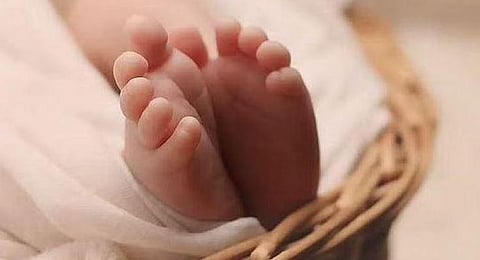 Representative image