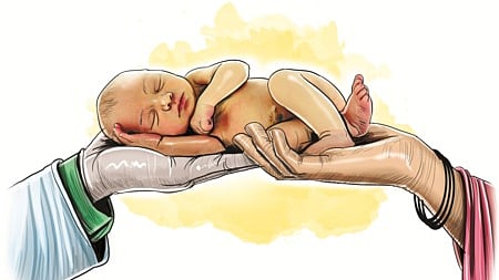 Representative image