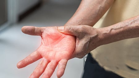 Image used for representational purpose.