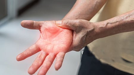 The man was admitted to a hospital in the Sinhgad Road after he complained of fever, loose motions and weakness in the lower limb and was diagnosed with GBS.