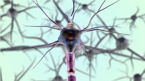 Representative picture of neurons