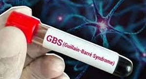 GBS