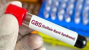 Image used for representative purpose.