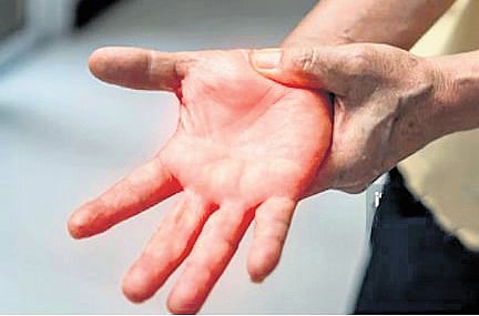 Affected individuals experience abnormal tingling or numbness 