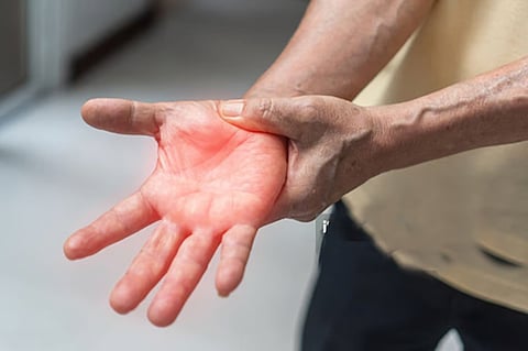 Symptoms of GBS include tingling and numbness, often starting in the feet, muscle weakness and pain, and difficulty walking