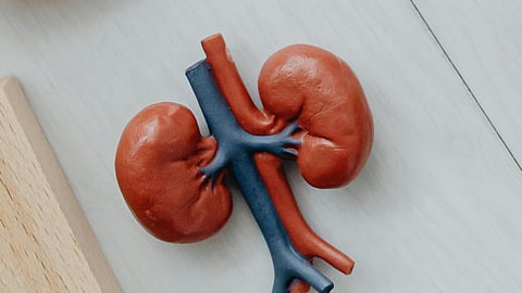 Representational image.