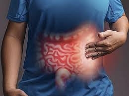 Know Irritable Bowel Syndrome in and out 