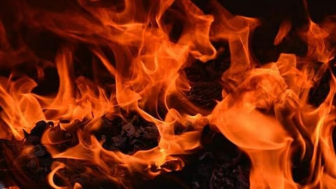 Teenager battling for life after allegedly being set on fire by father, stepmother
 in Sundargarh district