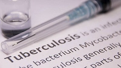 India among eight countries accounting for 67 per cent of total TB cases in 2024: WHO