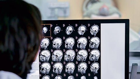 Representational image of a doctor studying a CT report