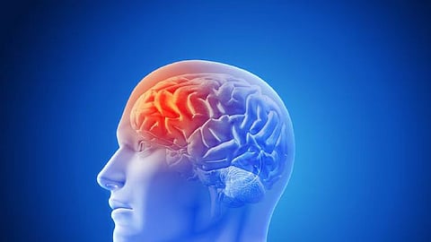 Pic for representation