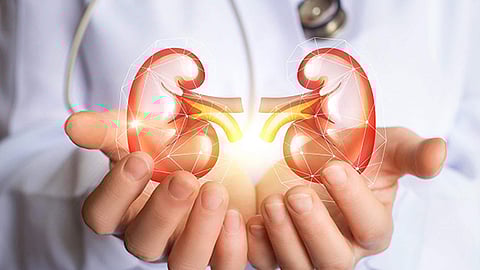 Representative Image