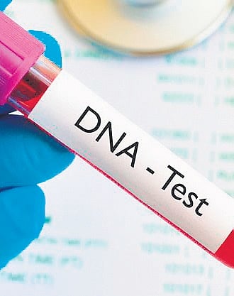 Image used for representational purposes