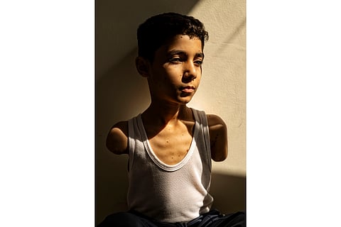 This image provided by World Press Photo and taken by Samar Abu Elouf, for The New York Times, won the World Press Photo Award of the Year and shows Mahmoud Ajjour (9), who was injured during an Israeli attack on Gaza City in March 2024, finds refuge and medical help in Doha, Qatar, 28 June 2024.