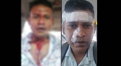  Indian Air Force Wing Commander Shiladitya Bose, who was injured in  the confrontation. 