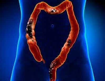 Image used for representation