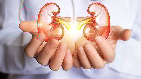 Representative Image