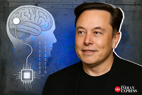 Brain-Computer Interface: How an FDA 'Breakthrough Tag' could expedite voice to the mute